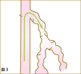 原因説明図3